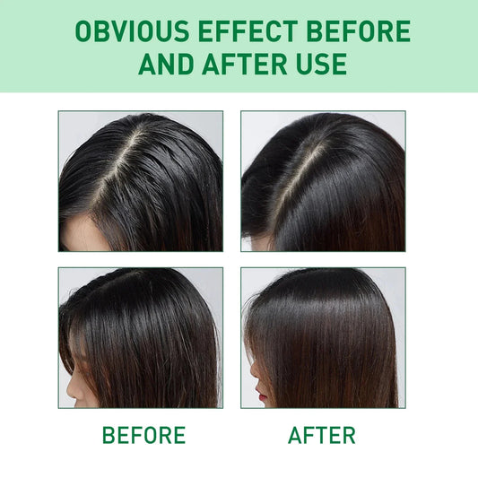 Fluffy Volumizing Hair Spray | Oil Control & Refreshing Dry Shampoo | Absorbs Grease & Cleans Scalp | Styling Mousse for Airy Hair - Cindorium