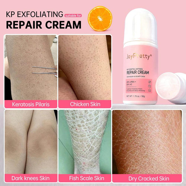 JoyPretty Exfoliating Repair Cream for Radiant Skin - Cindorium