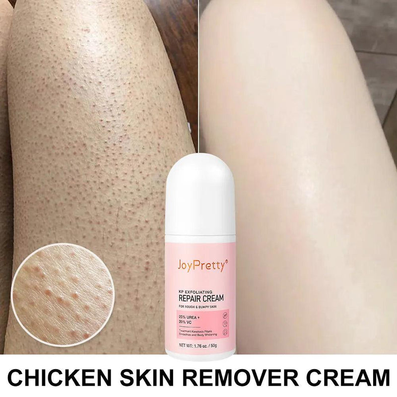 JoyPretty Exfoliating Repair Cream for Radiant Skin - Cindorium