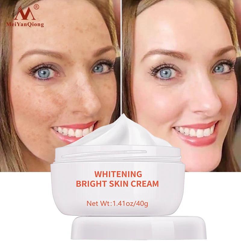 Dark Spot Remover Cream - Cindorium