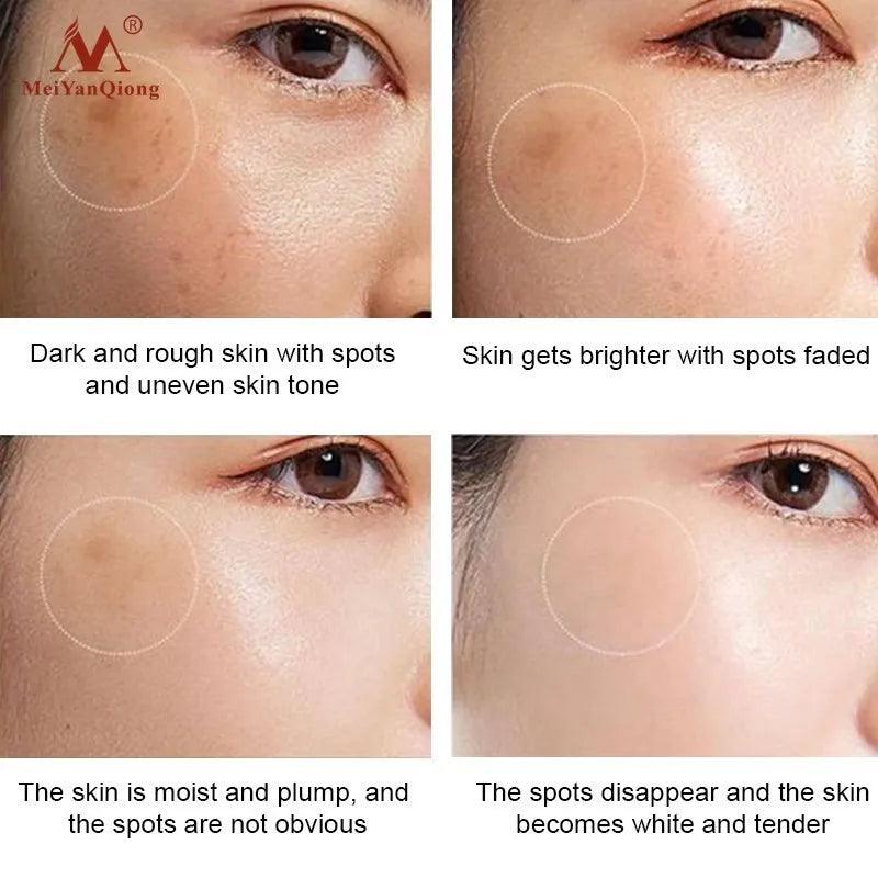 Dark Spot Remover Cream - Cindorium